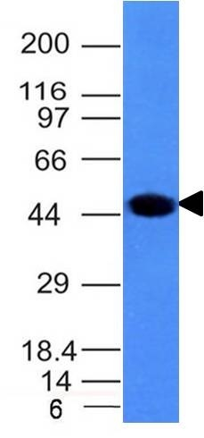 WB analysis of A431 cell lysate using GTX34663 Cytokeratin 8 antibody [H1].