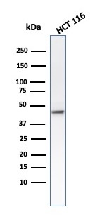 WB analysis of HCT116 cell lysate using GTX34664 Cytokeratin 8 antibody [B22.1].