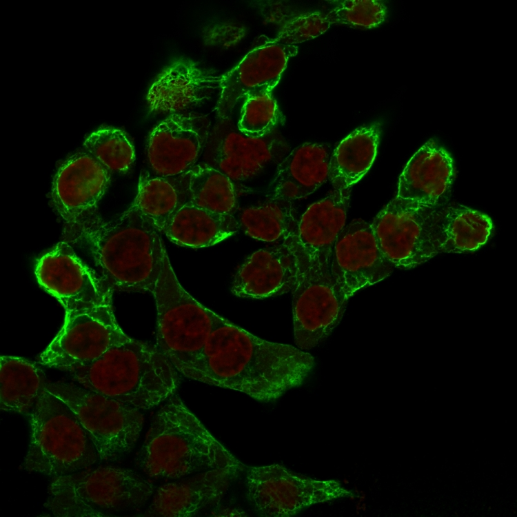 ICC/IF analysis of HCT116 cells using GTX34670 Cytokeratin 8 antibody [K8.8]. Green : Primary antibody Red : nucleus