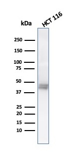 WB analysis of HCT116 cell lysate using GTX34670 Cytokeratin 8 antibody [K8.8].