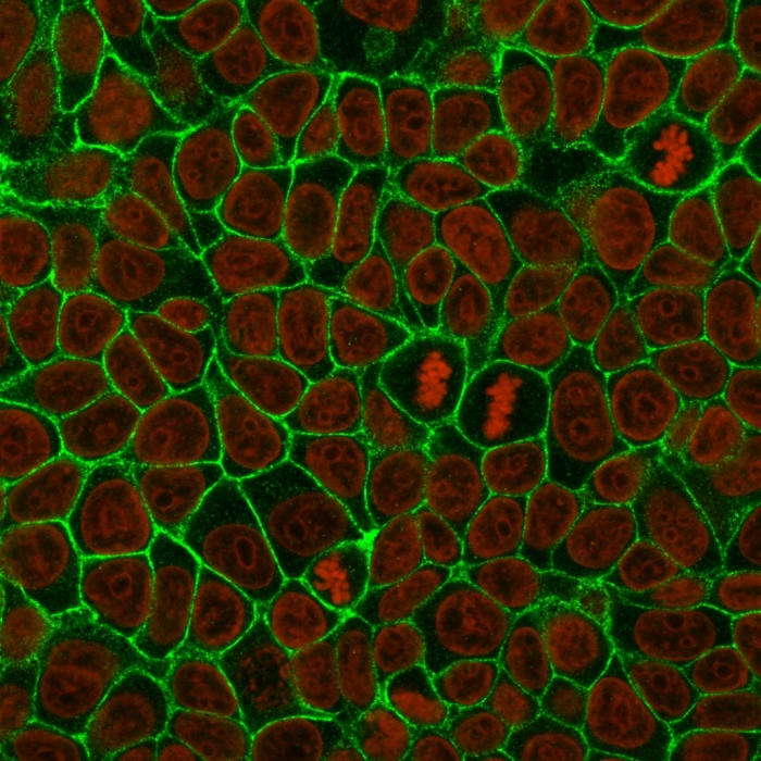 ICC/IF analysis of MCF-7 cells using GTX34679 E-Cadherin antibody [4A2]. Green : Primary antibody Red : nucleus