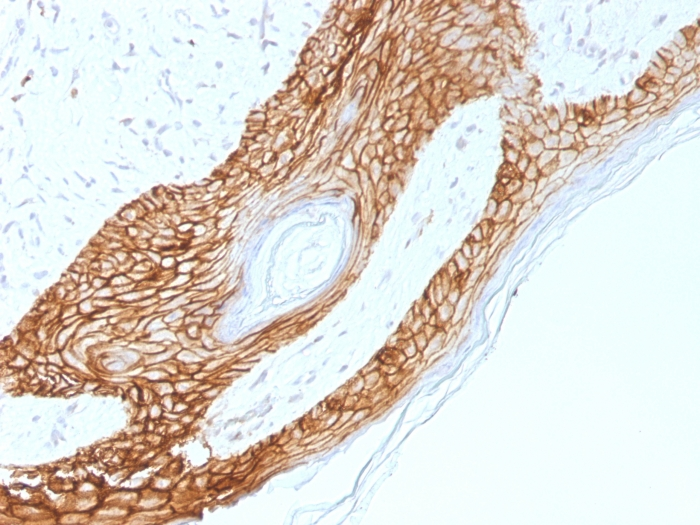 IHC-P analysis of human skin tissue using GTX34679 E-Cadherin antibody [4A2].