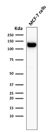 WB analysis of MCF-7 cell lysate using GTX34679 E-Cadherin antibody [4A2].