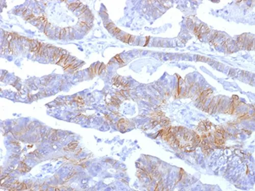 IHC-P analysis of human colon tissue using GTX34681 E-Cadherin antibody [SPM381].