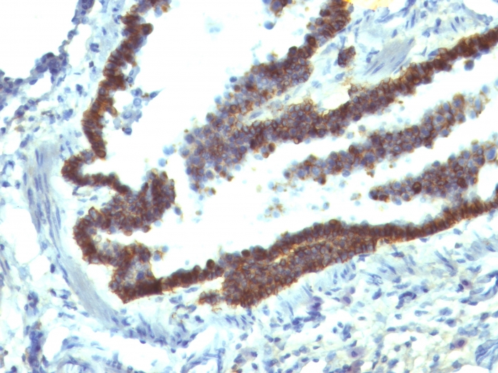 IHC-P analysis of rat lung tissue using GTX34691 EpCAM antibody [EGP40/1110].