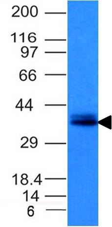 WB analysis of HCT116 cell lysate using GTX34692 EpCAM antibody [EGP40/1120].