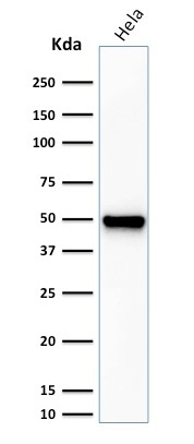WB analysis of HeLa cell lysate using GTX34717 Fascin 1 antibody [FSCN1/416].