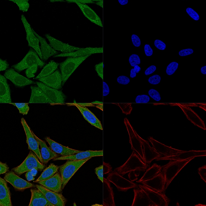 ICC/IF analysis of HeLa cells using GTX34718 Fascin 1 antibody [FSCN1/417]. Green : Primary antibody Red : Phalloidin Blue : nuclear counterstain