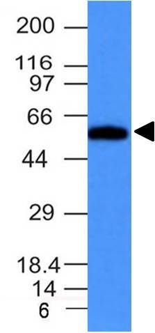 WB analysis of HeLa cell lysate using GTX34718 Fascin 1 antibody [FSCN1/417].
