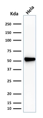 WB analysis of HeLa cell lysate using GTX34719 Fascin 1 antibody [SPM133].