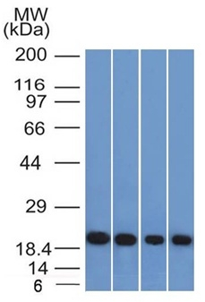 WB analysis of A431, HeLa, liver, and testis lysates using GTX34722 Ferritin Light Chain antibody [FTL/1386].