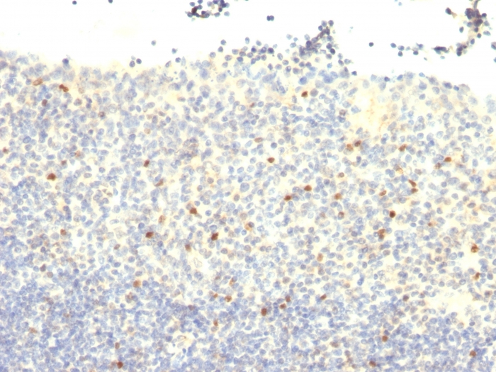 IHC-P analysis of human tonsil tissue using GTX34741 FOXP3 antibody [FXP3/197].
