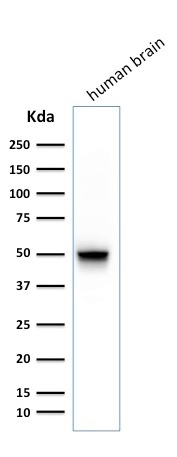 WB analysis of human brain tissue lysate using GTX34756 GFAP antibody [SPM248].