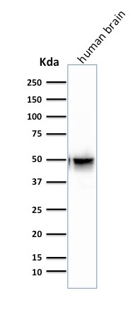 WB analysis of human brain tissue lysate using GTX34757 GFAP antibody [SPM507].