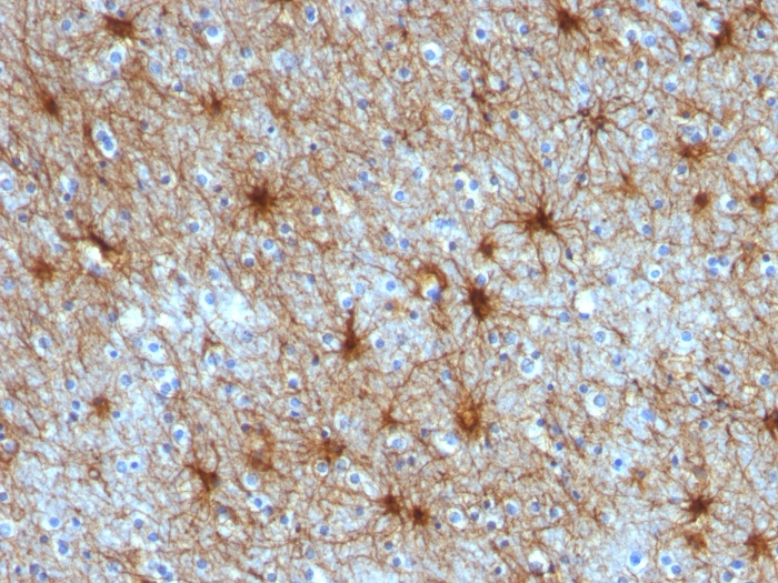 IHC-P analysis of human cerebellum tissue using GTX34758 GFAP antibody [ASTRO/789].
