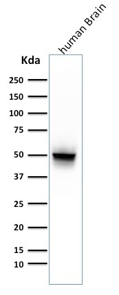 WB analysis of human brain tissue lysate using GTX34758 GFAP antibody [ASTRO/789].