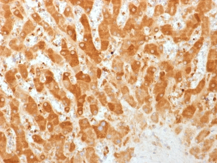IHC-P analysis of human liver tissue using GTX34760 GJB1 antibody [GJB1/1753].