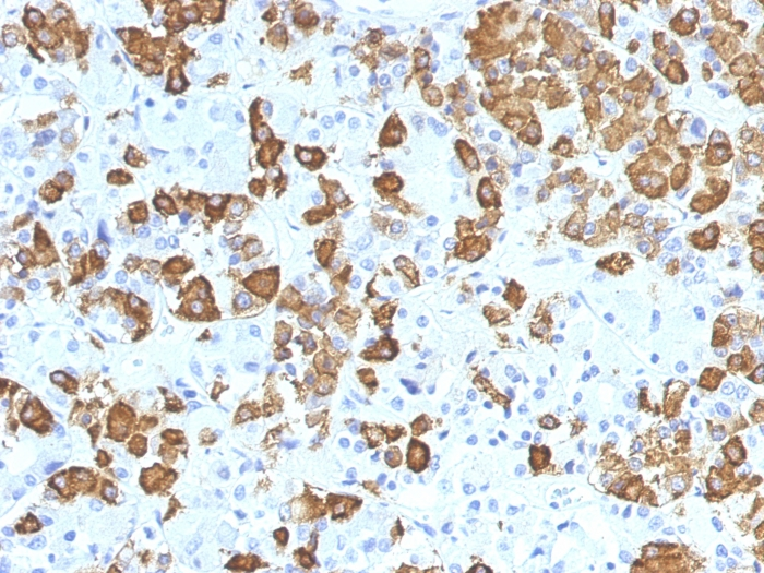 IHC-P analysis of human pituitary tissue using GTX34768 Growth Hormone antibody [GH/1371].