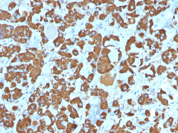 Formalin-fixed,paraffin-embedded Human Pituitary stained with Growth Hormone Monoclonal Antibody (SPM106).