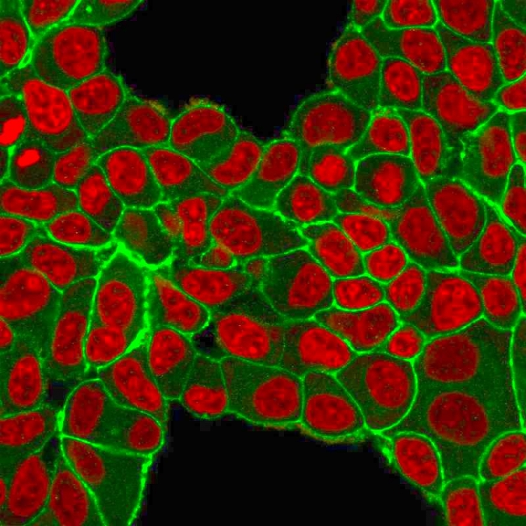 ICC/IF analysis of PFA-fixed MCF-7 cells using GTX34780 Her2 / ErbB2 antibody [HRB2/451]. Green : Primary antibody Red : nucleus