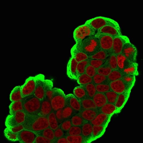 ICC/IF analysis of PFA-fixed MCF-7 cells using GTX34782 HSP27 antibody [SPM252]. Green : Primary antibody Red : nucleus