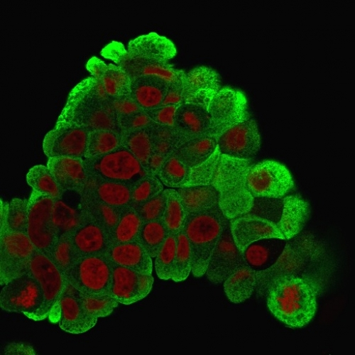 ICC/IF analysis of PFA-fixed MCF-7 cells using GTX34784 HSP27 antibody [G3.1]. Green : Primary antibody Red : nucleus