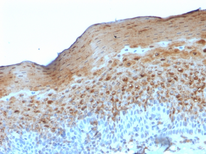 Formalin-fixed,paraffin-embedded human Tonsil stained with Involucrin Monoclonal Antibody (SY5)