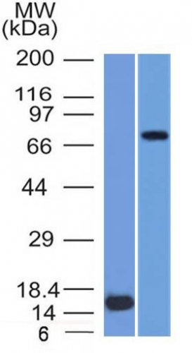 WB analysis of (1) recombinant MMP2 protein and (2) U87 cell lysates using GTX34845 MMP2 antibody [MMP2/1501].
