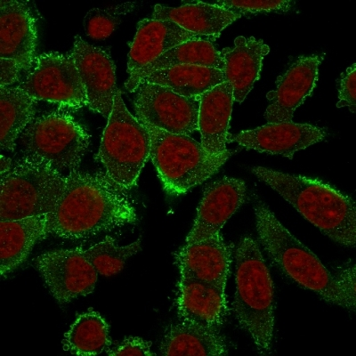 ICC/IF analysis of paraformaldehyde-fixed HeLa cells using GTX34848 Moesin antibody [MSN/492]. Green : Primary antibody Red : nucleus