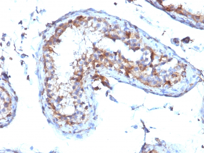 IHC-P analysis of human testicular carcinoma tissue using GTX34848 Moesin antibody [MSN/492].