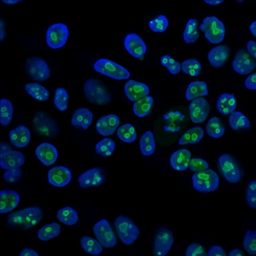 ICC/IF analysis of HeLa cells using GTX34915 Nucleolin antibody [SPM614]. Green : Primary antibody Blue : nucleus