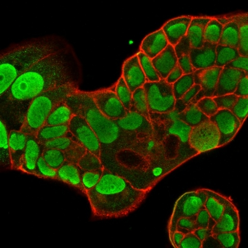 ICC/IF analysis of PFA-fixed MCF-7 cells using GTX34916 Nucleolin antibody [364-5]. Green : Primary antibody Red : Phalloidin