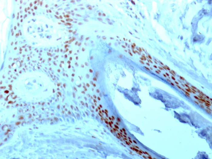 IHC-P analysis of human skin tissue using GTX34916 Nucleolin antibody [364-5].