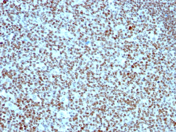IHC-P analysis of human tonsil tissue using GTX34916 Nucleolin antibody [364-5].