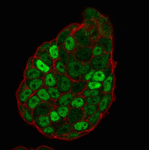 ICC/IF analysis of PFA-fixed MCF-7 cells using GTX34928 p27 Kip1 antibody [SX53G8]. Green : Primary antibody Red : Phalloidin