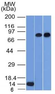WB analysis of recombinant p63 protein, PC3, and HeLa cell lysates using GTX34944 p63 antibody [TP63/1786].