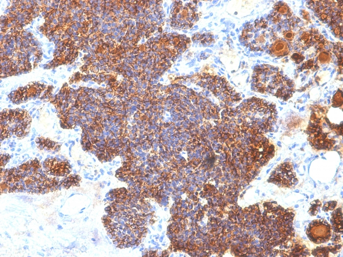 IHC-P analysis of human parathyroid tissue using GTX34951 Parathyroid Hormone antibody [PTH/1173].