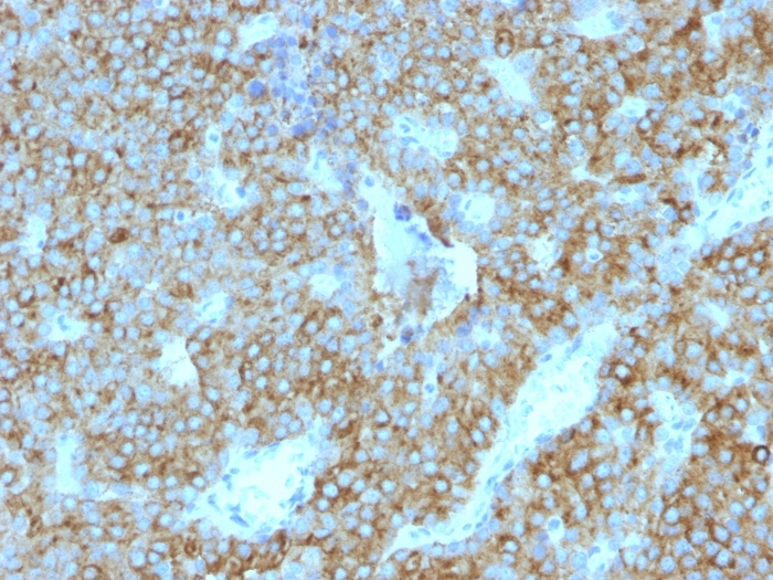 IHC-P analysis of human parathyroid gland tissue using GTX34953 Parathyroid Hormone antibody [PTH/1175].