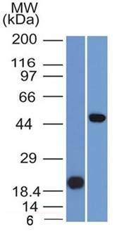 WB analysis of (A) recombinant PAX8 protein(B) Raji cell lysates using GTX34961 PAX8 antibody [PAX8/1491].