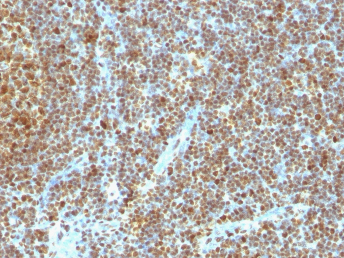 Formalin-fixed,paraffin-embedded human Tonsil stained with PCNA Monoclonal Antibody (SPM350)