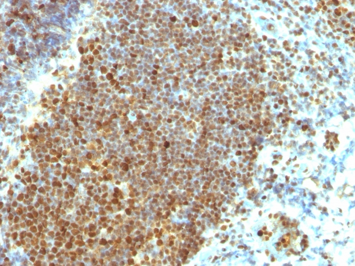IHC-P analysis of human tonsil tissue using GTX34964 PCNA antibody [PCNA/694].