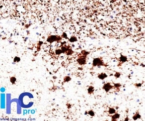 IHC-P analysis of human brain tissue using GTX34969 PGP9.5 antibody [31A3].
