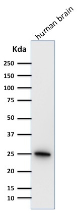 WB analysis of human brain tissue lysate using GTX34969 PGP9.5 antibody [31A3].
