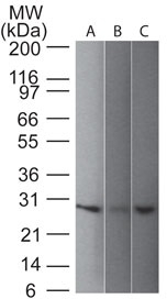 WB analysis of (1) human, (2) Mouse, and (3) rat brain tissue lysates using GTX34969 PGP9.5 antibody [31A3].