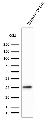WB analysis of human brain tissue lysate using GTX34970 PGP9.5 antibody [SPM574].
