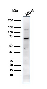 WB analysis of JEG-3 cell lysate using GTX34975 Placental Alkaline Phosphatase antibody [PL8-F6].