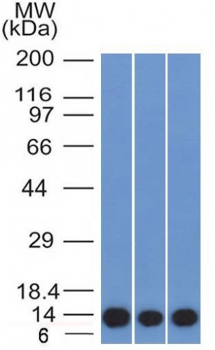 WB analysis of HeLa, A549, and A375 cell lysates using GTX34999 S100A4 antibody [S100A4/1481].