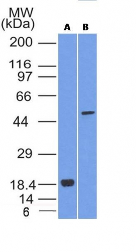 WB analysis of (A) SOX10 recombinant protein and (B) A375 cell lysates using GTX35084 SOX10 antibody [SOX10/1074].