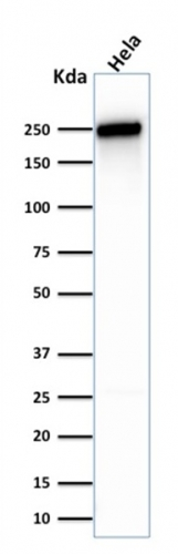 WB analysis of HeLa cell lysate using GTX35090 SPTBN2 antibody [SPTBN2/1583].