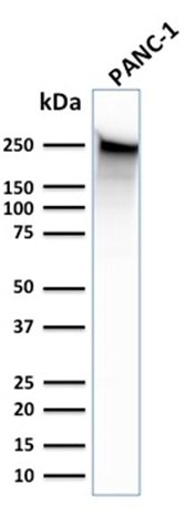 WB analysis of PANC-1 cell lysate using GTX35090 SPTBN2 antibody [SPTBN2/1583].